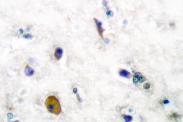Polyclonal Rabbit anti-Human GABBR1 / GABA B Receptor 1 Antibody (Ile902, IHC, WB)