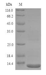 Salmonella typhi lptD Protein (Recombinant 6His, N-terminus)