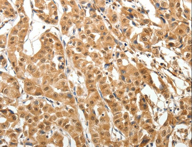 Polyclonal Rabbit anti-Human MAP1L / MAP1A Antibody (IHC)