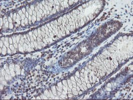 TDO2 Antibody (clone OTI2A4)