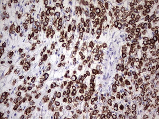 Monoclonal Mouse anti-Human KRT19 / CK19 / Cytokeratin 19 Antibody (clone OTI1F5, aa240-390, IHC, WB)