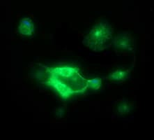 IHC-plus™ CDH3 / P-Cadherin Antibody (clone 2D5)
