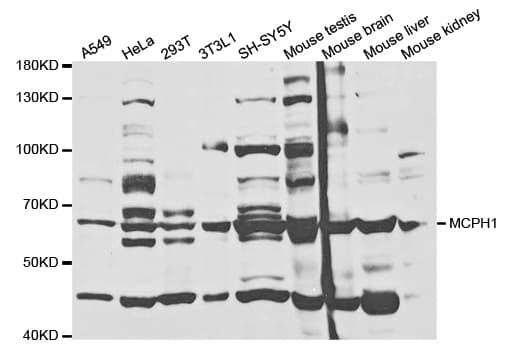 MCPH1 Antibody