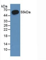 ESR2 / ER Beta Antibody