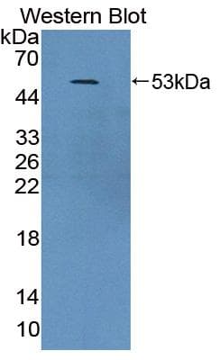 MTIF2 Antibody (Biotin)