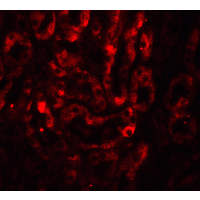IL17A Antibody
