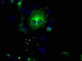 Monoclonal Mouse anti-Human BAP / SIL1 Antibody (clone OTI1G7, IHC, IF, WB)