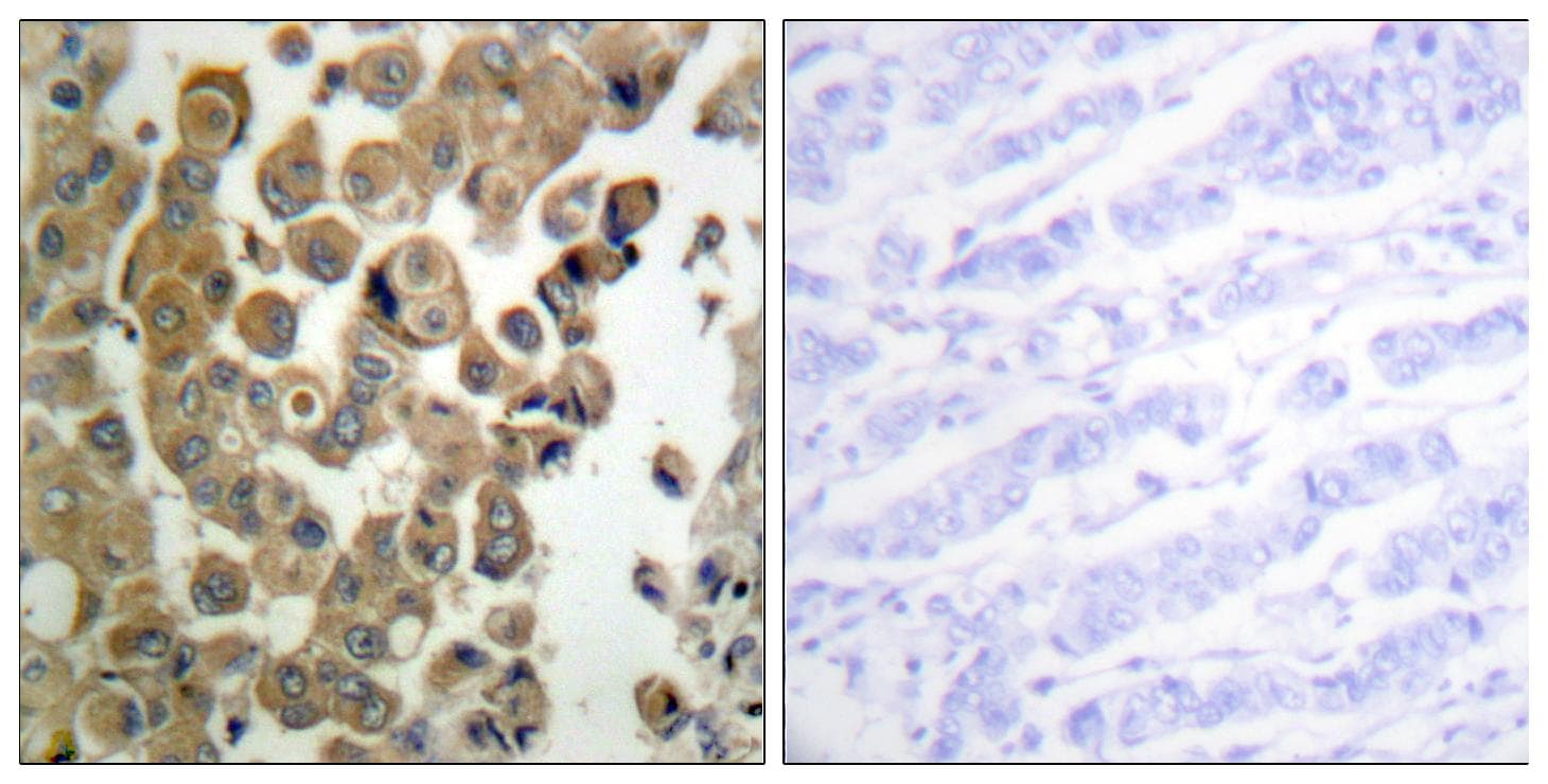 PRKCD / PKC-Delta Antibody (phospho-Thr505)