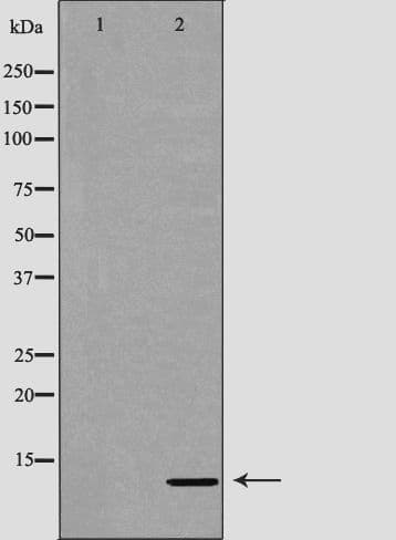 FKBP1A / FKBP12 Antibody