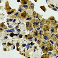 SAPK / JNK / MAPK8 + MAPK9 + MAPK10 Antibody (Internal)