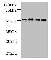Polyclonal Rabbit anti-Human TTC38 Antibody (IHC, WB)