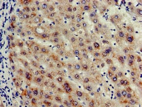 Polyclonal Rabbit anti-Human CASP12 / Caspase 12 Antibody (IHC, IF, WB)