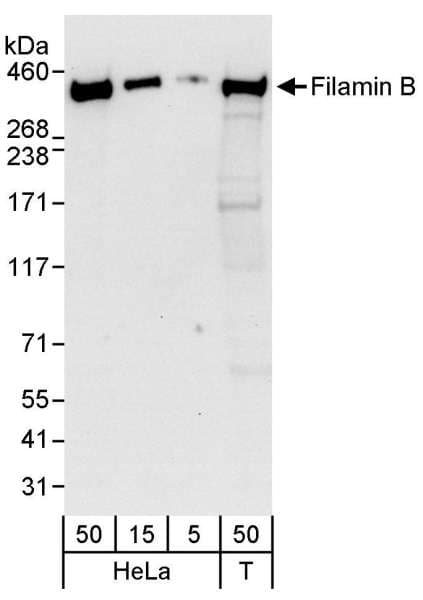 Polyclonal Rabbit anti-Human FLNB / TAP Antibody (aa975-1025, WB)