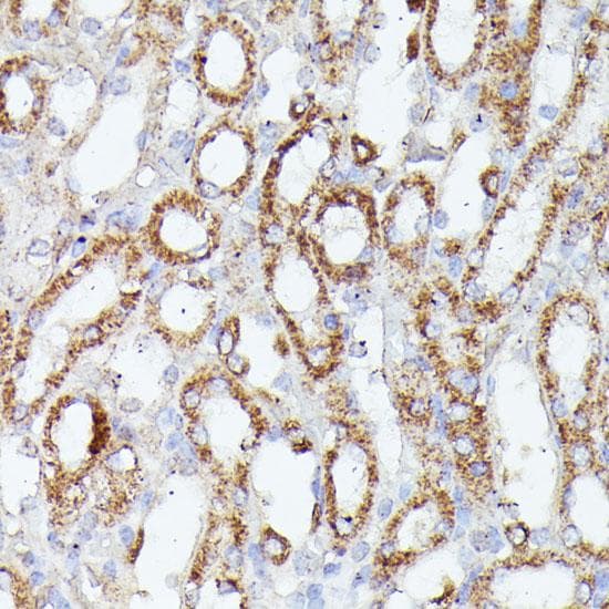 HSPC167 / CDK5RAP1 Antibody