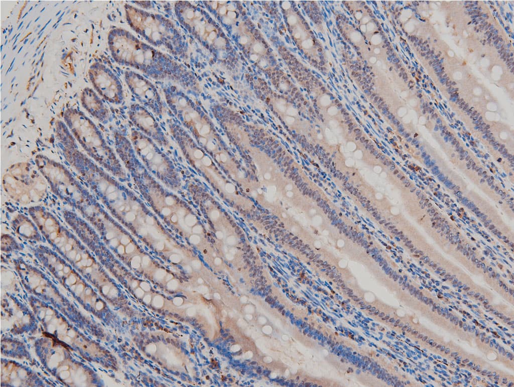 LIMK1 / LIMK Antibody (phospho-Thr508)