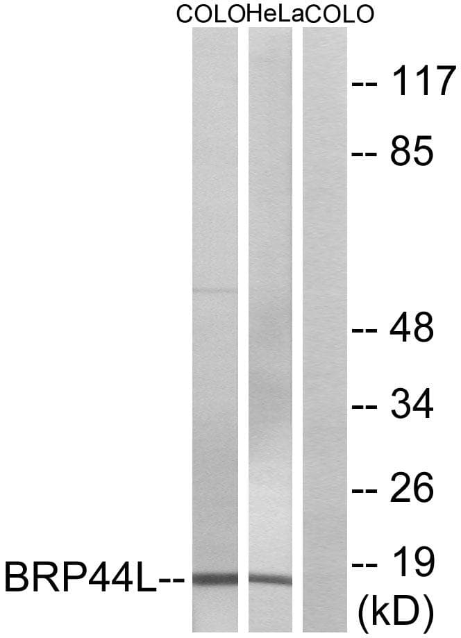 Polyclonal Rabbit anti-Human BRP44L Antibody (IHC, IF, WB)