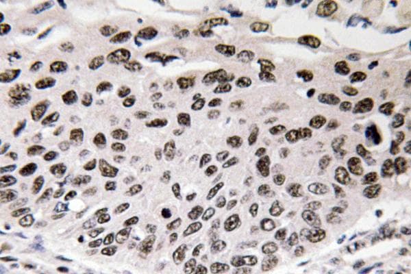 Polyclonal Rabbit anti-Human CCND3 / Cyclin D3 Antibody (Gly277, IHC, WB)