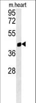 Polyclonal Rabbit anti-Human PTGR1 / LTB4DH Antibody (aa177-205, WB)