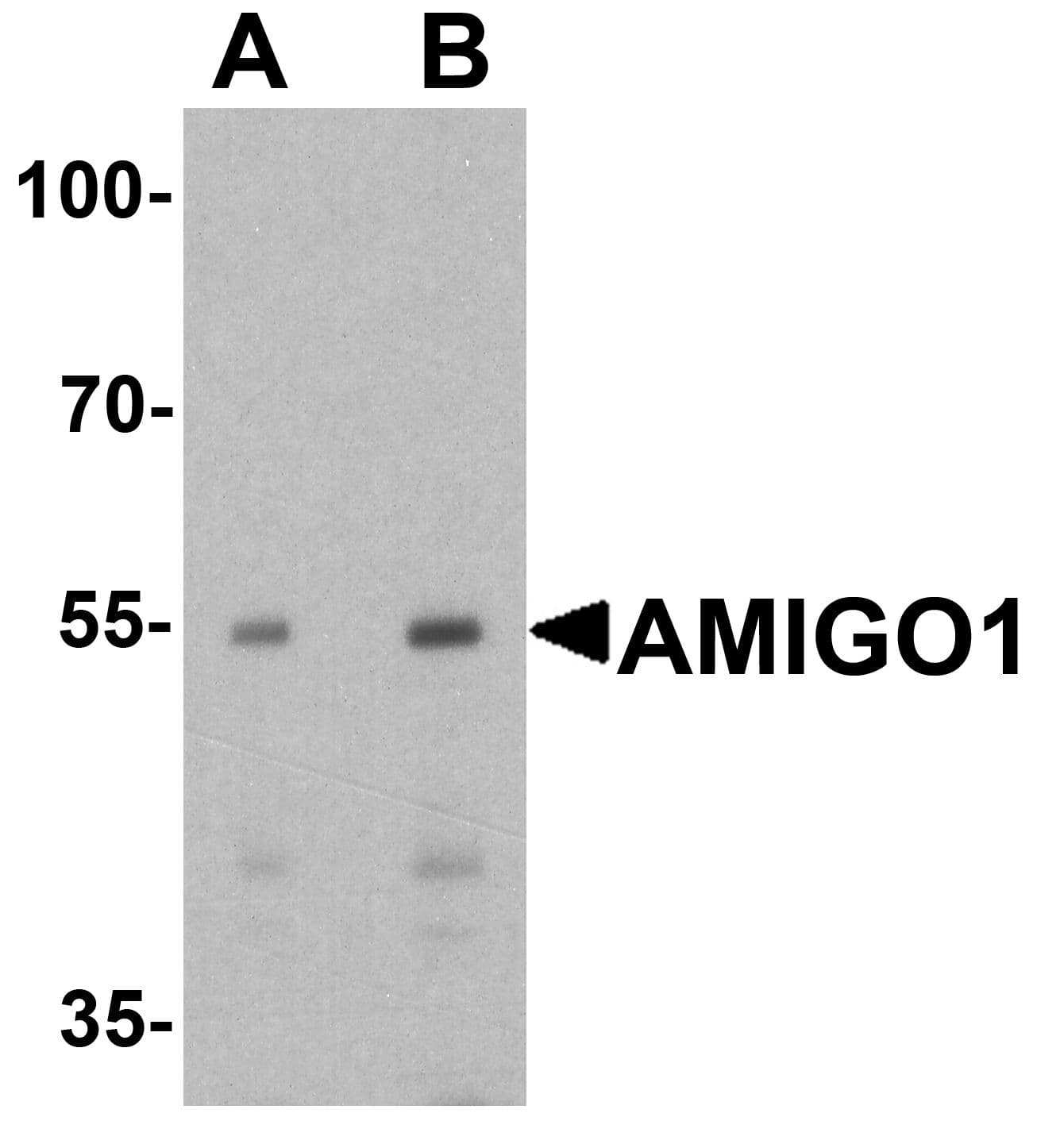 IHC-plus™ Polyclonal Rabbit anti-Human AMIGO Antibody (IHC, IF, WB)