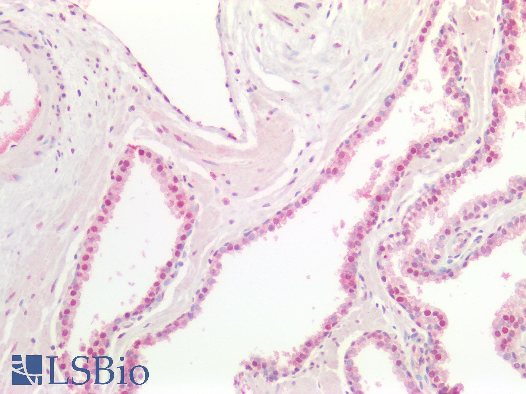 PathPlus™ Polyclonal Rabbit anti-Human MYC / c-Myc Antibody (IHC)