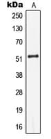 KRT13 / CK13 / Cytokeratin 13 Antibody (Internal)