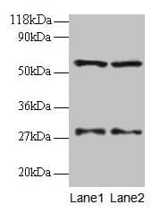 SARS / Serine-tRNA Ligase Antibody