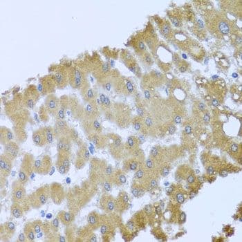 ACP1 / Acid Phosphatase Antibody