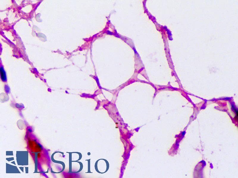 IHC-plus™ Polyclonal Rabbit anti-Human Adiponectin Antibody (IHC, WB)