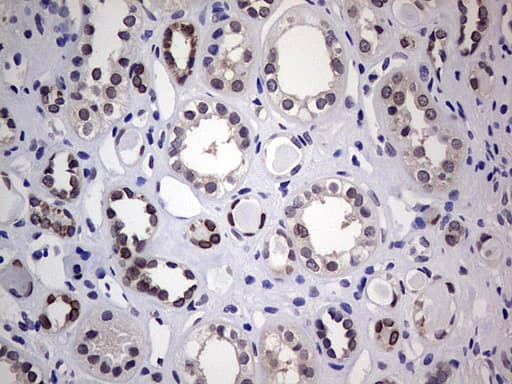 Monoclonal Mouse anti-Human HDAC9 Antibody (clone OTI3D10, aa181-460, IHC)