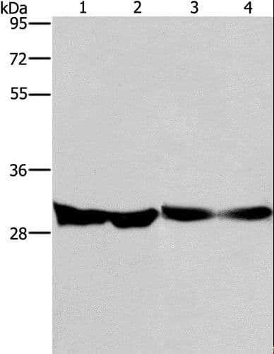 Polyclonal Rabbit anti-Human DECR1 Antibody (IHC, WB)