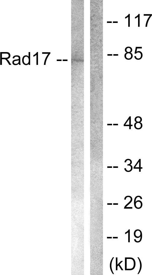 Polyclonal Rabbit anti-Human RAD17 Antibody (p645, IHC, IF, WB)