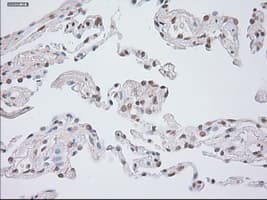 GAD1 / GAD67 Antibody (clone OTI3H2)