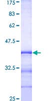 Human RAB8A / RAB8 Protein (Recombinant GST, N-terminus)