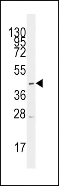 SLC16A1 / MCT1 Antibody (aa200-228)