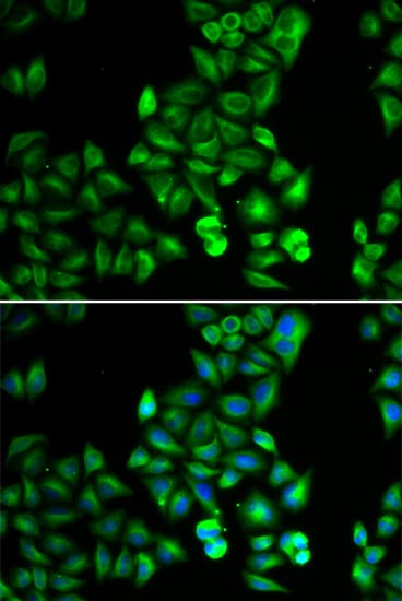 DRD5 / Dopamine Receptor D5 Antibody