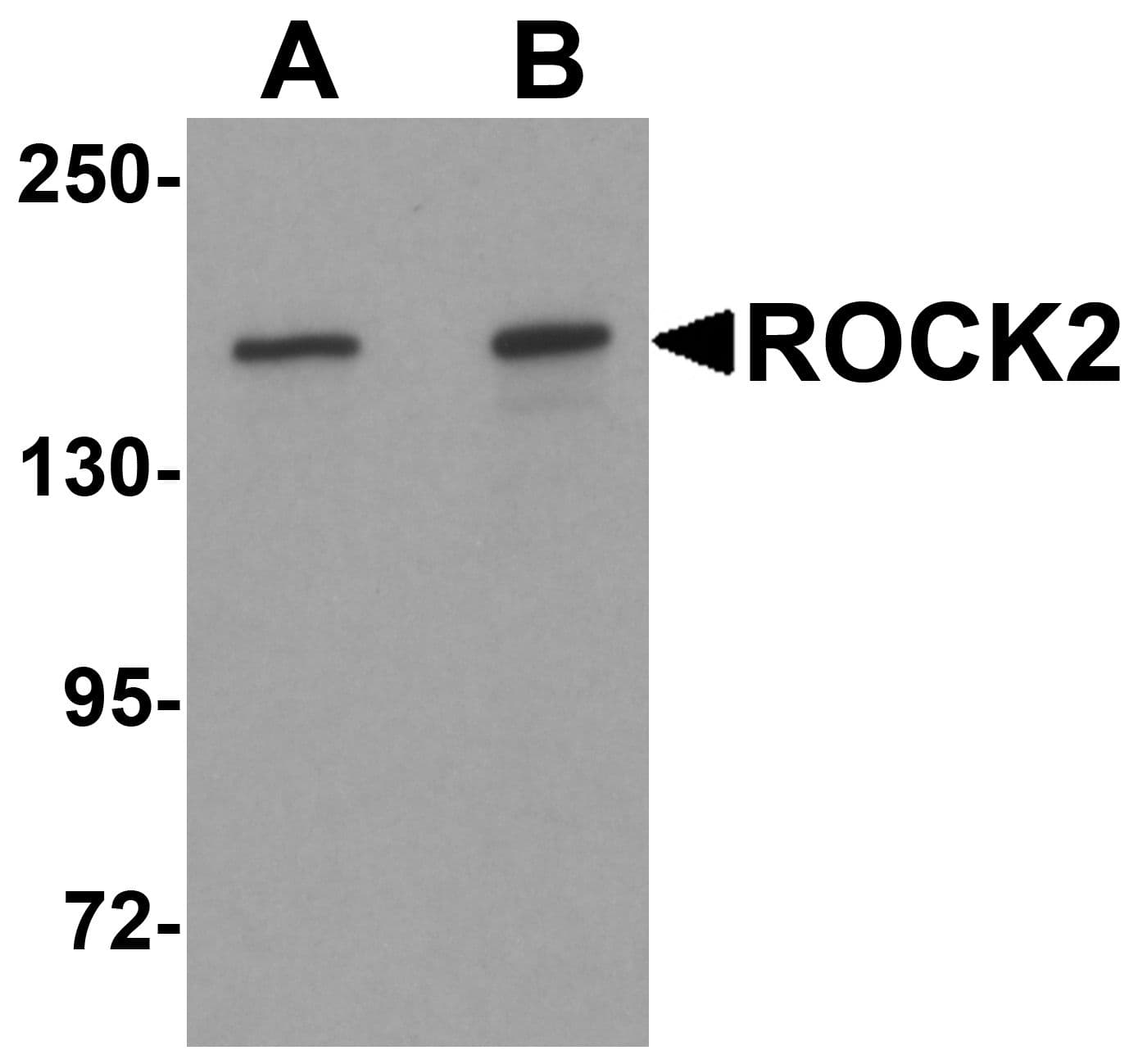 IHC-plus™ Polyclonal Rabbit anti-Human ROCK2 Antibody (IHC, IF, WB)