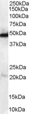 PathPlus™ NDRG1 Antibody (aa382-394)
