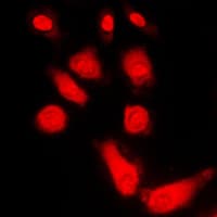 Polyclonal Rabbit anti-Human PRKACA + PRKACB + PRKACG Antibody (Internal, IHC, IF, WB)