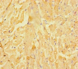 LRRC15 Antibody