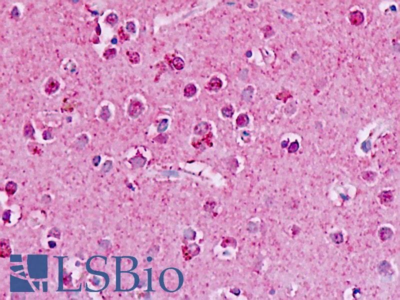 IHC-plus™ GPR182 / ADMR Antibody