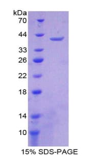 Human MT-ND1 Protein (Recombinant His-GST)