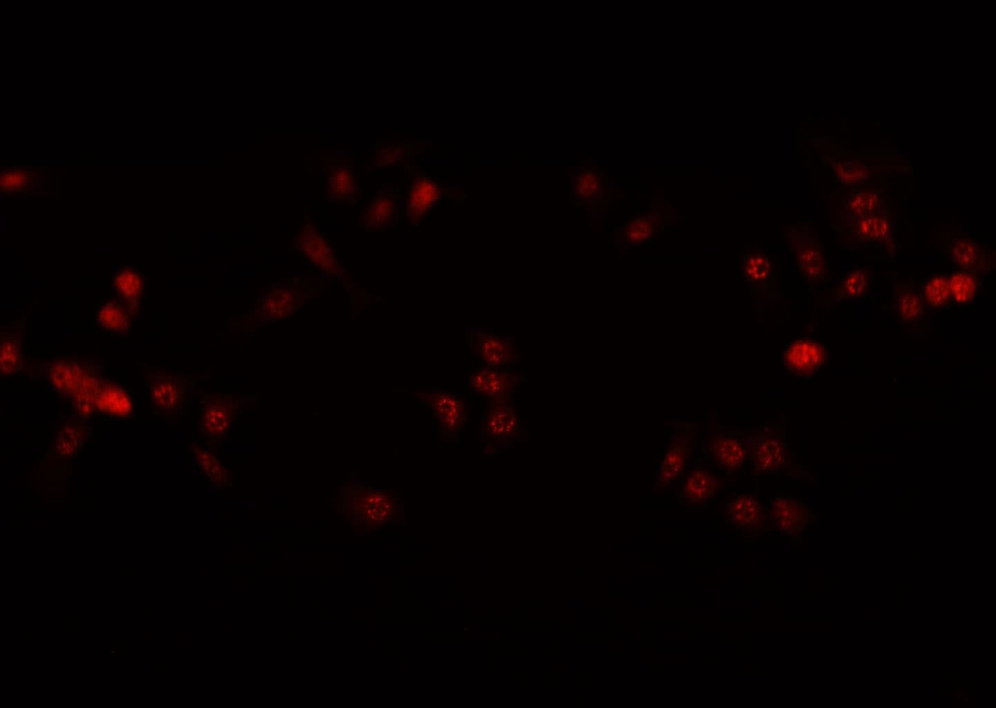 HDAC1 Antibody
