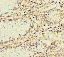 Polyclonal Rabbit anti-Human BCO1 / BCMO1 Antibody