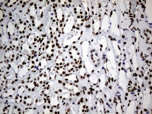 Monoclonal Mouse anti-Human HNRNPH1 / hnRNP H Antibody (clone OTI4F10, Carrier-free, IHC, WB)