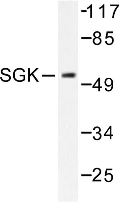 SGK1 / SGK Antibody (Pro73)