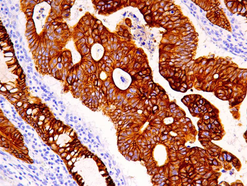 Monoclonal Mouse anti-Human KRT19 / CK19 / Cytokeratin 19 Antibody (clone AHC0096, IHC)