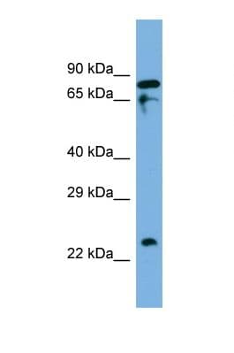 IDH3B Antibody (C-Terminus)