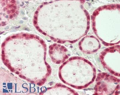 IHC-plus™ SF3B1 Antibody (aa100-150)