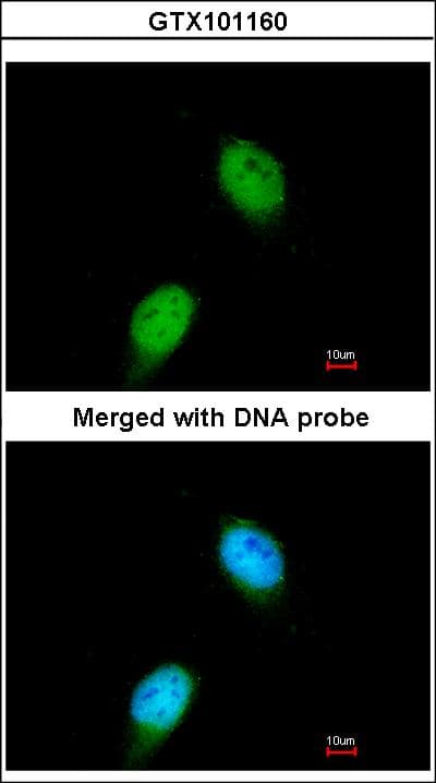 MLH1 Antibody