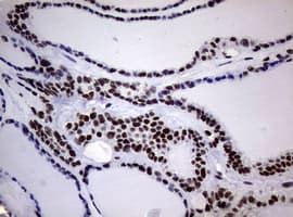 NBN / Nibrin Antibody (clone OTI9H2)